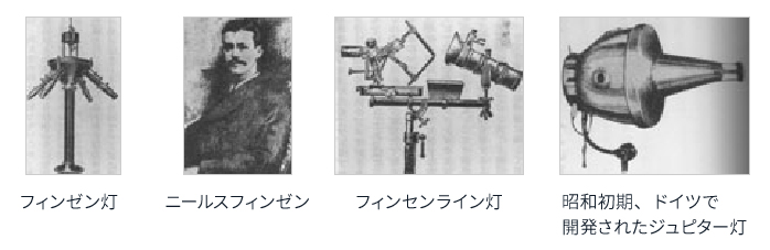 フィンゼン灯、ニールスフィンゼン、フィンセンライン灯、昭和初期、ドイツで開発されたジュピター灯